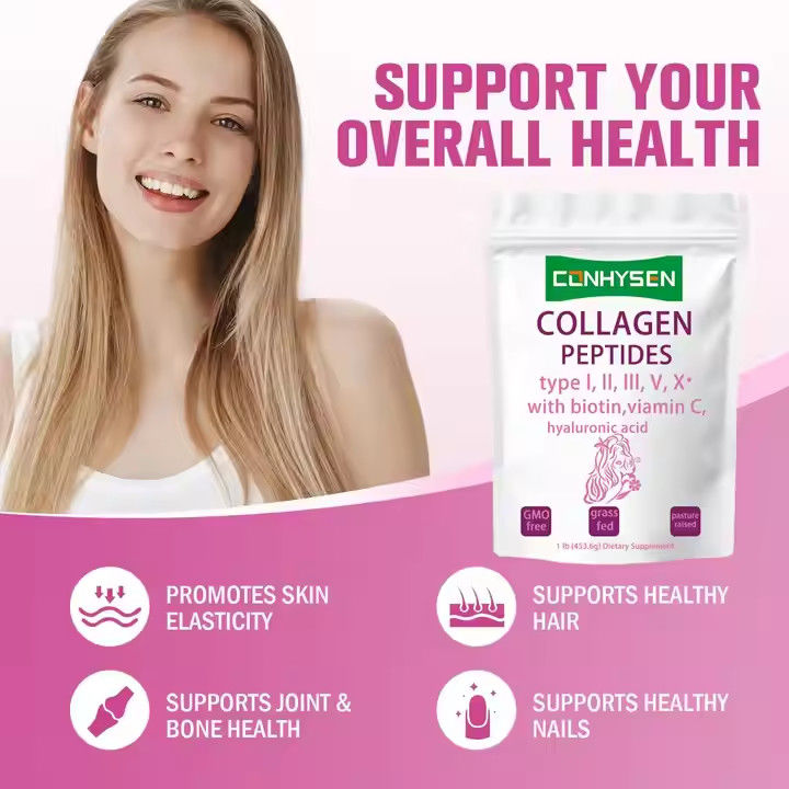 Suplementos OEM Péptidos de colágeno en polvo para la piel y el cabello Salud articular Apoya el envejecimiento